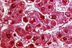 La OMS anuncia fin del brote de ébola en Sierra Leona y de la transmisión del virus en África occidental