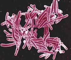 La OMS y Sudáfrica pretenden acabar con la tuberculosis para 2030