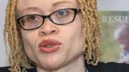 La ONU alerta sobre la extinción total de los albinos en Malaui
