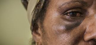 El efecto invisible del ébola en Sierra Leona
