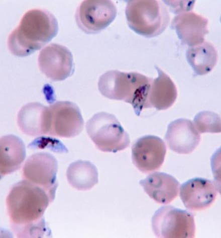 ¿Podremos erradicar la malaria?, por Bartolomé Burgos