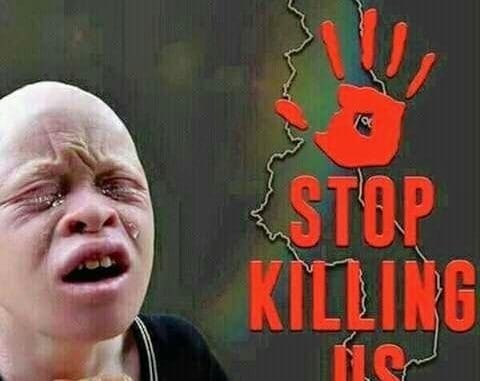 La Asociación de Personas con Albinismo en Malaui quiere que Mutharika declare al país un lugar peligroso para los albinos