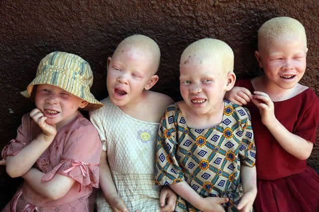 Tanzania arresta a 65 brujos por el asesinato ritual de al menos 10 niños