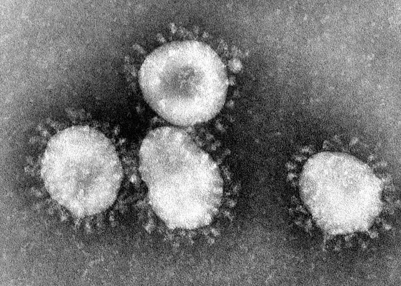 Argelia confirma el segundo caso de coronavirus en África