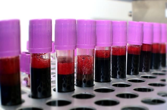 La sangre se pagará por adelantado en Zimbabue