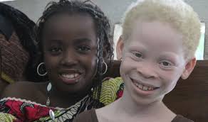 albino_2.jpg